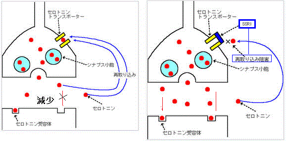 ポーター セロトニン トランス